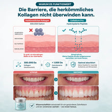 Lade das Bild in den Galerie-Viewer, CollaGum Pro – Kollagen-Zahnfleischpflege für Reparatur, Aufbau & Regeneration