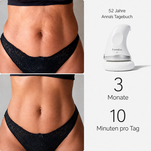 Formkur - Anti-Cellulite Massagegerät für Bauch, Beine & Po