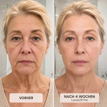 Lade das Bild in den Galerie-Viewer, LumaLift Pro – 3-in-1 Straffungs- &amp; Massagegerät für Gesicht, Arme &amp; Körper