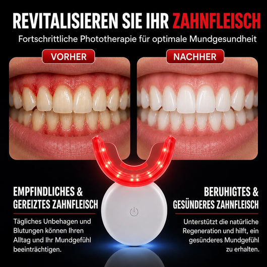 Zahnfleischvital Pro - Zahnfleisch wieder aufbauen in nur 10 Minuten pro Tag