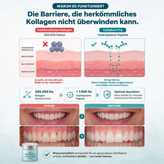 CollaGum Pro – Kollagen-Zahnfleischpflege für Reparatur, Aufbau & Regeneration