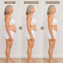 Lade das Bild in den Galerie-Viewer, Formkur - Anti-Cellulite- &amp; Bindegewebs-Massagegerät
