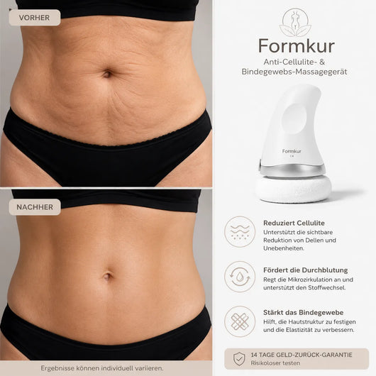 Formkur - Anti-Cellulite- & Bindegewebs-Massagegerät